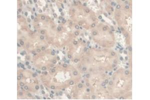 IHC-P analysis of Rat Kidney Tissue, with DAB staining. (Androgen Receptor Antikörper  (AA 491-679))