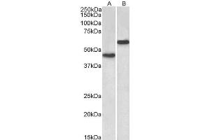 ABIN2613449 (2µg/ml) staining of Human Cerebellum (A) and Liver (B) lysates (35µg protein in RIPA buffer). (LYVE1 Antikörper  (Internal Region))
