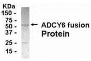 Western Blotting (WB) image for anti-Adenylate Cyclase 6 (ADCY6) (AA 1-121) antibody (ABIN2467944)