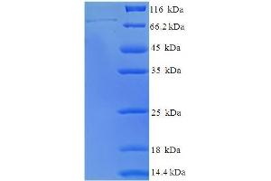 SDS-PAGE (SDS) image for Polymerase (RNA) III (DNA Directed) Polypeptide C (62kD) (POLR3C) (AA 1-534), (full length) protein (His-SUMO Tag) (ABIN5711825)
