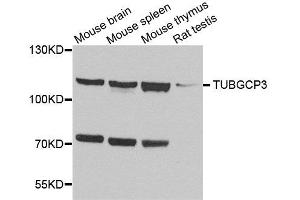 Western blot analysis of extracts of various cell lines, using TUBGCP3 antibody. (TUBGCP3 Antikörper  (AA 1-250))