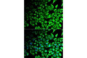 Immunofluorescence analysis of HeLa cells using DPP7 antibody (ABIN5973952). (DPP7 Antikörper)