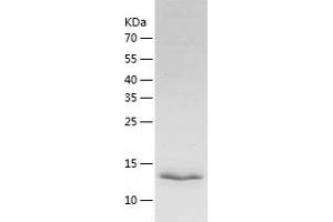 Western Blotting (WB) image for Granulysin (GNLY) (AA 23-145) protein (His tag) (ABIN7285686) (GNLY Protein (AA 23-145) (His tag))