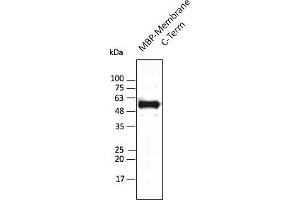Western Blotting (WB) image for anti-SARS-CoV-2 Membrane Protein (SARS-CoV-2 M) (C-Term) antibody (ABIN7273010)