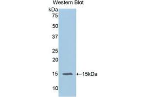 Western blot analysis of the recombinant protein. (IL-15 Antikörper  (AA 49-162))