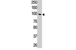 The Tlr5 polyclonal antibody  is used in Western blot to detect TLR5 in HL-60 cell lysate. (TLR5 Antikörper  (N-Term))