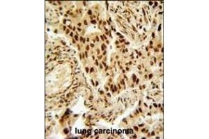 Immunohistochemistry (Paraffin-embedded Sections) (IHC (p)) image for anti-Histone Deacetylase 2 (HDAC2) (AA 410-439) antibody (ABIN653718)