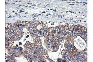 Image no. 2 for anti-Phosphatidylinositol-4-Phosphate 3-Kinase, Catalytic Subunit Type 2 beta (PIK3C2B) antibody (ABIN1500198) (PIK3C2B Antikörper)