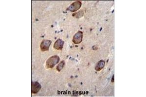 Immunohistochemistry (Paraffin-embedded Sections) (IHC (p)) image for anti-Calcium Channel, Voltage-Dependent, gamma Subunit 6 (CACNG6) (AA 108-136) antibody (ABIN655983)