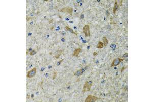 Immunohistochemistry of paraffin-embedded mouse spinal cord using TXN2 antibody.
