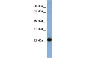 WB Suggested Anti-CAV1 Antibody Titration:  0. (Caveolin-1 Antikörper  (N-Term))