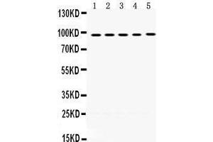 Western Blotting (WB) image for anti-Minichromosome Maintenance Deficient 8 (MCM8) (AA 809-840), (C-Term) antibody (ABIN3042508) (MCM8 Antikörper  (C-Term))