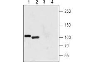 anti-Polycystic Kidney Disease 2 (Autosomal Dominant) (PKD2) (AA 914-927), (Intracellular) antibody