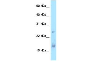 WB Suggested Anti-DYNLL1 Antibody Titration: 1. (DYNLL1 Antikörper  (Middle Region))