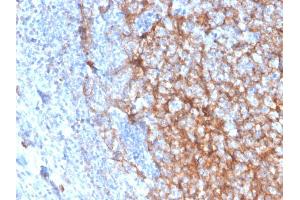 Immunohistochemistry (IHC) image for anti-Integrin alpha M (ITGAM) (AA 941-1074) antibody (ABIN6939812)