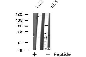 Western blot analysis of extracts from HT29 cells, using SP100 antibody. (SP100 Antikörper  (Internal Region))