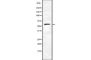 Western blot analysis of CARD9 using K562 whole cell lysates (CARD9 Antikörper  (C-Term))