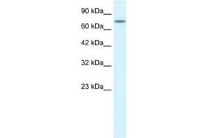WB Suggested Anti-RIPK1 Antibody Titration:  0. (RIPK1 Antikörper  (Middle Region))