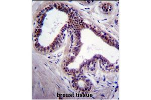 PK8 Antibody (C-term) (ABIN391724 and ABIN2841613) immunohistochemistry analysis in forlin fixed and paraffin embedded hun breast tissue followed by peroxidase conjugation of the secondary antibody and DAB staining. (JNK Antikörper  (C-Term))