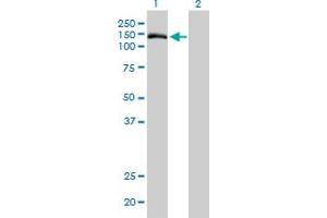 Western Blot analysis of TMEM1 expression in transfected 293T cell line by TMEM1 monoclonal antibody (M01), clone 5B4.