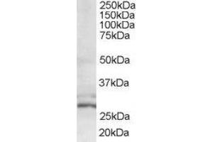 ABIN2560426 (0. (HIV-1 Tat Interactive Protein 2, 30kDa (HTATIP2) (N-Term) Antikörper)