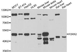 Western blot analysis of extracts of various cell lines, using P2RX2 antibody (ABIN5975474) at 1/1000 dilution. (P2RX2 Antikörper)
