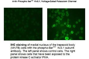 Immunohistochemical staining of Anti-Potassium Channel, Voltage-Gated, Kv3.