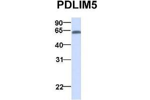 Host:  Rabbit  Target Name:  PDLIM5  Sample Type:  Human Adult Placenta  Antibody Dilution:  1. (PDLIM5 Antikörper  (N-Term))