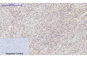 Immunohistochemical analysis of paraffin-embedded human uterus tissue. (EIF2A Antikörper)