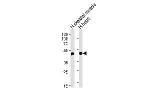 Western Blotting (WB) image for anti-Hemochromatosis Type 2 (Juvenile) (HFE2) (AA 134-162) antibody (ABIN653653)