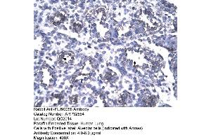 Human Lung (FOXP1 Antikörper  (N-Term))