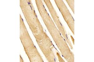 (ABIN6243629 and ABIN6577994) staining CHST1 in Human skeletal muscle tissue sections by Immunohistochemistry (IHC-P - paraformaldehyde-fixed, paraffin-embedded sections). (CHST1 Antikörper  (C-Term))