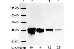 Lane 1: MarkerLane 2-5: 40 ng, 8 ng, 1. (RFP Antikörper)