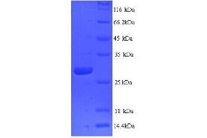 SDS-PAGE (SDS) image for Cathepsin K (CTSK) (AA 115-329) protein (His tag) (ABIN5713386)