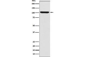 Western blot analysis of GPR49 expression in Human fetal skeletal muscle lysate.