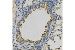 Immunohistochemistry of paraffin-embedded mouse lung using PSAT1 Antibody (ABIN6293473) at dilution of 1:100 (40x lens). (PSAT1 Antikörper)