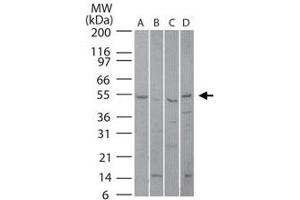 Western blot analysis of PIAS4 in (A) human liver, (B) mouse liver, (C) rat liver and (D) human Jurkat lysate using PIAS4 polyclonal antibody  at 5 ug/mL . (PIAS4 Antikörper  (AA 46-60))
