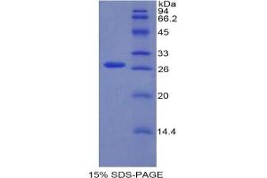 SDS-PAGE analysis of Mouse RUNX2 Protein. (RUNX2 Protein)