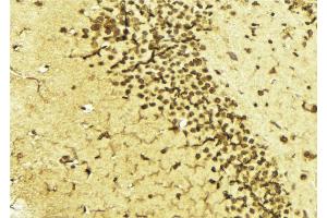 ABIN6268870 at 1/100 staining Mouse brain tissue by IHC-P. (TFAP2A Antikörper  (C-Term))