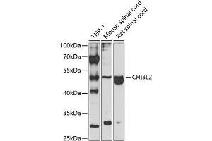 Western blot analysis of extracts of various cell lines, using CHI3L2 antibody (ABIN6132056, ABIN6138529, ABIN6138530 and ABIN6223574) at 1:1000 dilution. (CHI3L2 Antikörper  (AA 27-390))