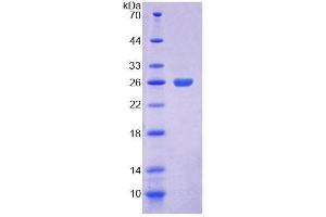 SDS-PAGE analysis of Mouse COASY Protein.