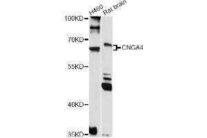 Western blot analysis of extracts of various cell lines, using CNGA4 antibody (ABIN6291315) at 1:1000 dilution.