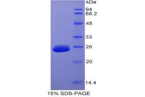 SDS-PAGE (SDS) image for Fibroblast Growth Factor 15 (FGF15) (AA 25-218) protein (His tag) (ABIN2121051) (FGF15 Protein (AA 25-218) (His tag))
