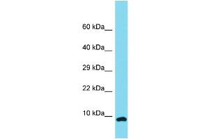Host: Rabbit Target Name: C12orf75 Sample Type: NCI-H226 Whole Cell lysates Antibody Dilution: 1. (OCC-1 Antikörper  (N-Term))