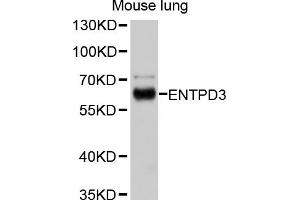 Western blot analysis of extracts of mouse lung, using ENTPD3 antibody (ABIN4903580) at 1:1000 dilution. (ENTPD3 Antikörper)