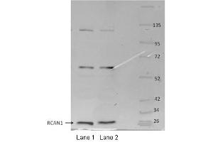Western Blotting (WB) image for anti-Regulator of Calcineurin 1 (RCAN1) (Middle Region) antibody (ABIN2780590)