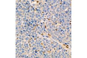 Immunohistochemistry of paraffin embedded mouse myeloma using MNDA (ABIN7074709) at dilution of 1:2000 (400x lens) (MNDA Antikörper)