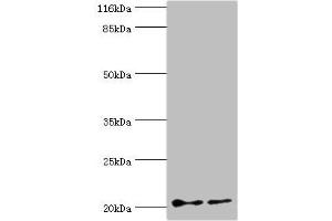 Western blot All lanes: UBE2C antibody at 2 μg/mL Lane 1: Hela whole cell lysate Lane 2: U87 whole cell lysate Secondary Goat polyclonal to rabbit IgG at 1/10000 dilution Predicted band size: 20, 16, 17, 18 kDa Observed band size: 20 kDa (UBE2C Antikörper  (AA 2-179))
