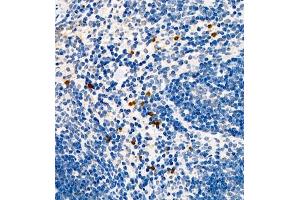 Immunohistochemistry of paraffin embedded mouse spleen using CCL3 (ABIN7073450) at dilution of 1:1000 (400x lens) (CCL3 Antikörper)