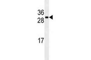 CDCA8 antibody western blot analysis in U251 lysate (CDCA8 Antikörper)
